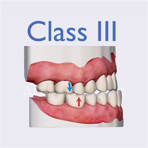 Class 3 .